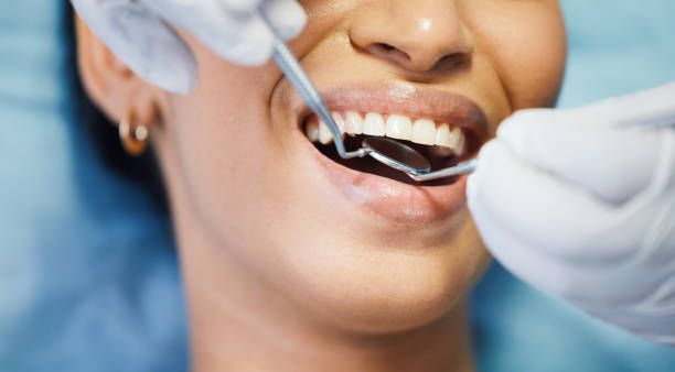 Best Emergency Tooth Extraction  in Aberdeen, WA