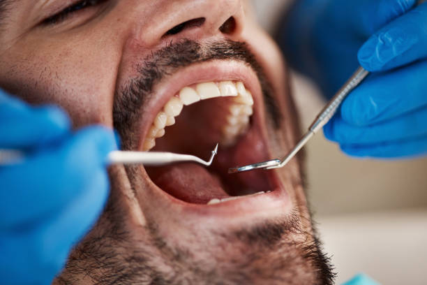 Dentist for Dental Trauma in WA