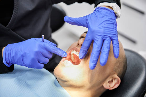 Best Root Canal Emergency Dentist  in Aberdeen, WA
